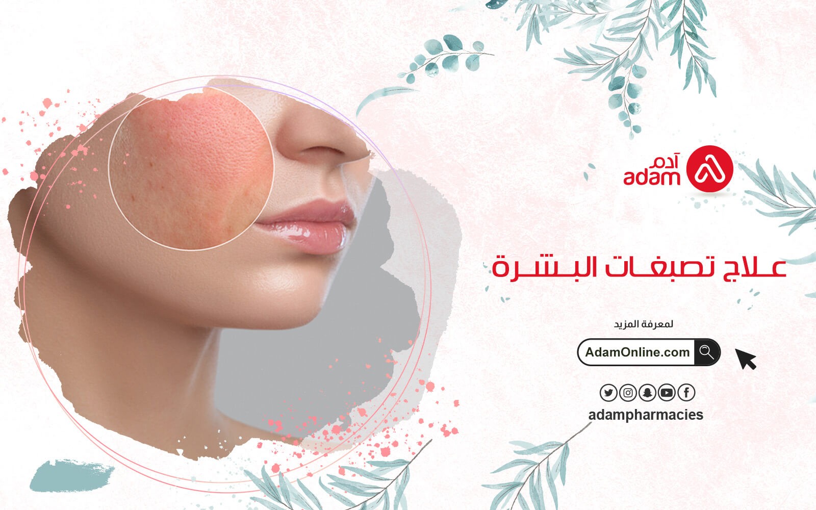 علاج تصبغات البشرة